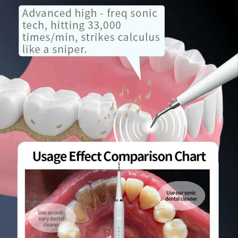 Oceantree Electric Teeth Cleaner Tartar Ultrasonic Tooth Cleaner Teeth Dental Scaler Tartar Remover Usb Electric Tooth Brush Electric Toothbrushes for Adult