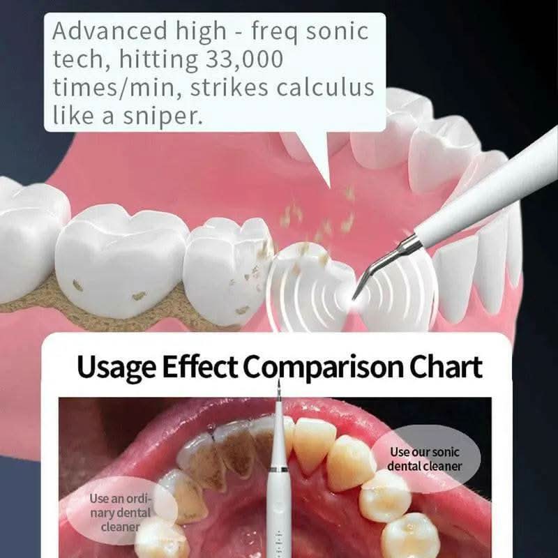 Oceantree Electric Teeth Cleaner Tartar Ultrasonic Tooth Cleaner Teeth Dental Scaler Tartar Remover Usb Electric Tooth Brush Electric Toothbrushes for Adult